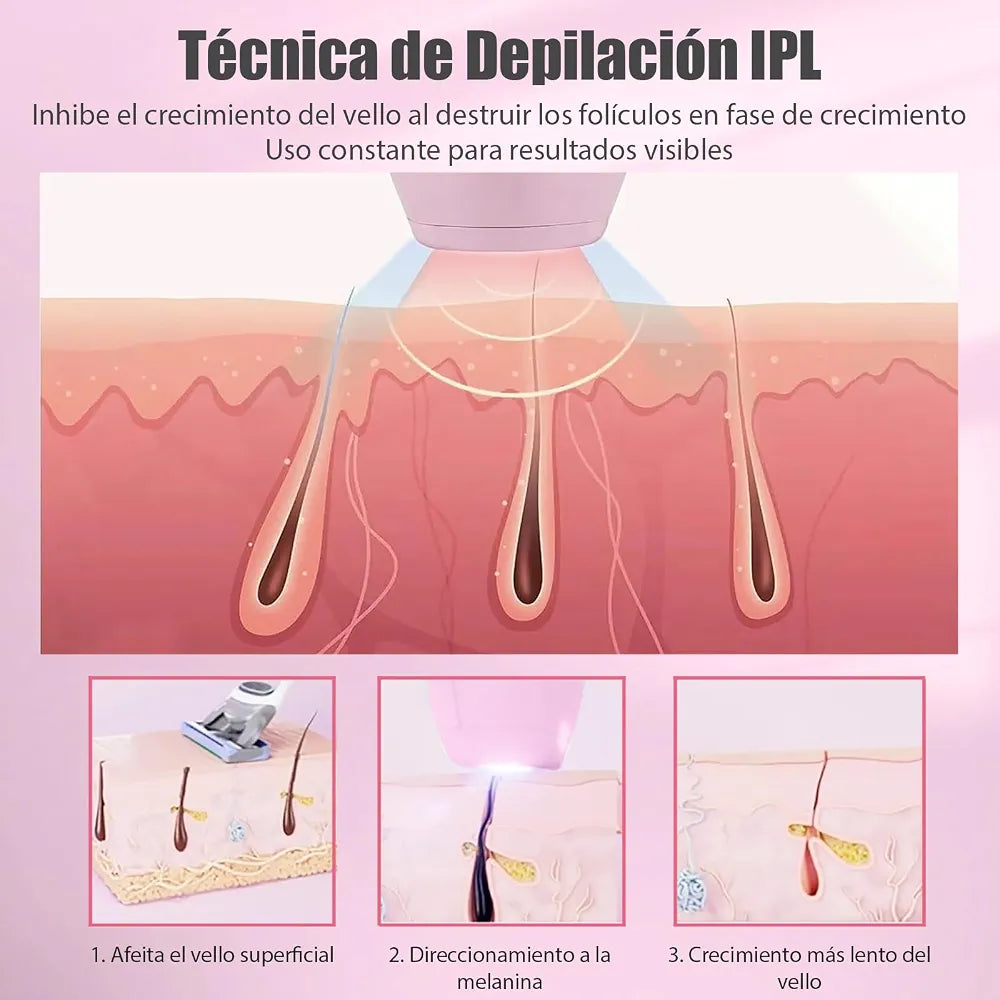 Depiladora IPL de Luz Pulsada para Casa – 5 Niveles